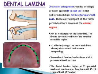 20 areas of enlargement(rounded swellings)
or knobs appear(10 in each jaw) which
will form tooth buds for the 20 primary/milk
teeth. These epithelial part of the tooth
germs/buds are known as the enamel
organs.
•Not all will appear at the same time. The
first to develop are those of the anterior
mandible region
• At this early stage, the tooth buds have
already determined their crown
morphology
•Successional lamina: lamina from which
permanent teeth develop
•The dental lamina begins at 6th prenatal
week and continues to function until 15-18
years of birth (3rd molar)
 