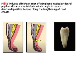 HERS induces differentiation of peripheral radicular dental
papilla cells into odontoblasts which begin to deposit
dentin.(deposition follows along the lengthening of root
sheath)
 