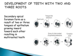 Secondary apical
foramen form as a
result of two or three
tongues of epithelium
growing inward
toward each other
resulting in
multirooted teeth
 