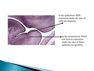 What are the signals responsible for initiation of tooth bud
formation?
In the epithelium: SHH
expression marks the sites of
tooth development
In the mesenchyme, PAX9
and Activin expression
marks the sites of future
epithelial invagination
 