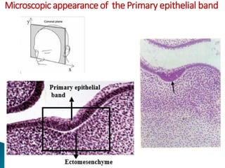 Microscopic appearance of the Primary epithelial band
 