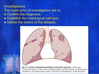 Investigations
The main aims of investigation are to:
● Confirm the diagnosis.
● Establish the histological cell type.
● Define the extent of the disease.
11
 
