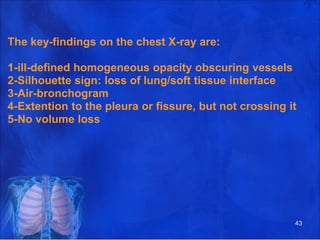 The key-findings on the chest X-ray are:
1-ill-defined homogeneous opacity obscuring vessels
2-Silhouette sign: loss of lung/soft tissue interface
3-Air-bronchogram
4-Extention to the pleura or fissure, but not crossing it
5-No volume loss
43
 