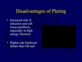 Disadvantages of Plating
• Increased risk of
infection and soft
tissue problems,
especially in high
energy fractures
• Higher rate hardware
failure than IM nail
 