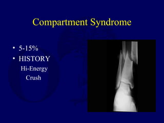 Compartment Syndrome
• 5-15%
• HISTORY
Hi-Energy
Crush
 