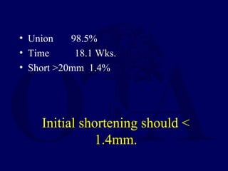 Initial shortening should <
1.4mm.
• Union 98.5%
• Time 18.1 Wks.
• Short >20mm 1.4%
 