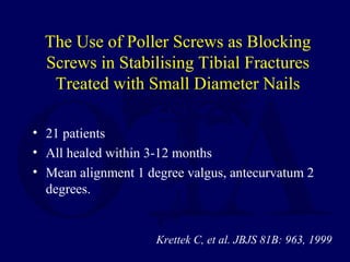 The Use of Poller Screws as Blocking
Screws in Stabilising Tibial Fractures
Treated with Small Diameter Nails
• 21 patients
• All healed within 3-12 months
• Mean alignment 1 degree valgus, antecurvatum 2
degrees.
Krettek C, et al. JBJS 81B: 963, 1999
 
