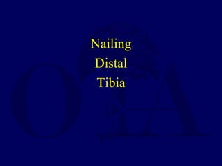 Nailing
Distal
Tibia
 