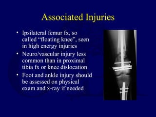Associated Injuries
• Ipsilateral femur fx, so
called “floating knee”, seen
in high energy injuries
• Neuro/vascular injury less
common than in proximal
tibia fx or knee dislocation
• Foot and ankle injury should
be assessed on physical
exam and x-ray if needed
 