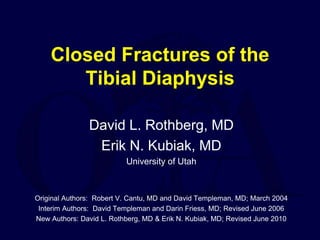 Closed Fractures of the
Tibial Diaphysis
David L. Rothberg, MD
Erik N. Kubiak, MD
University of Utah
Original Authors: Robert V. Cantu, MD and David Templeman, MD; March 2004
Interim Authors: David Templeman and Darin Friess, MD; Revised June 2006
New Authors: David L. Rothberg, MD & Erik N. Kubiak, MD; Revised June 2010
 