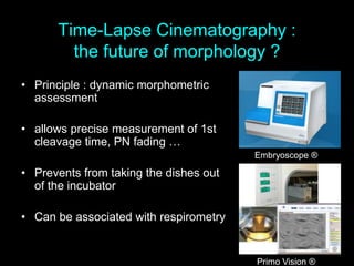 Time-Lapse Cinematography :
the future of morphology ?
• Principle : dynamic morphometric
assessment
• allows precise measurement of 1st
cleavage time, PN fading …
• Prevents from taking the dishes out
of the incubator
• Can be associated with respirometry
Embryoscope ®
Primo Vision ®
 