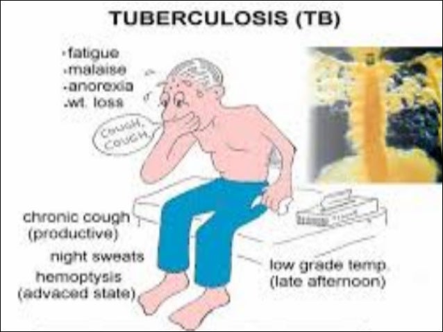 L11 12.PULMONARY TB