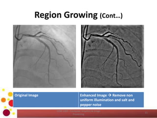 Region Growing (Cont…)
COM 2304 - Computer Graphics & Image
Processing
11
Original Image Enhanced Image  Remove non
uniform illumination and salt and
pepper noise
 
