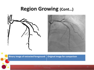 Region Growing (Cont…)
COM 2304 - Computer Graphics & Image
Processing
14
Binary image of extracted foreground Original image for comparison
 