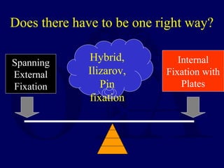 Spanning
External
Fixation
Internal
Fixation with
Plates
Hybrid,
Ilizarov,
Pin
fixation
Does there have to be one right way?
 