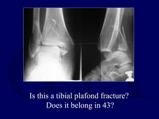 Is this a tibial plafond fracture?
Does it belong in 43?
 