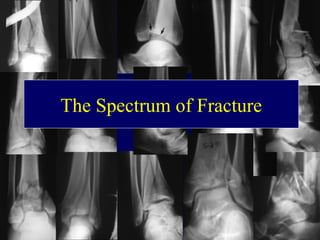The Spectrum of Fracture
 