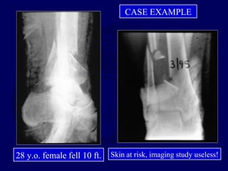CASE EXAMPLE
28 y.o. female fell 10 ft. Skin at risk, imaging study useless!
 