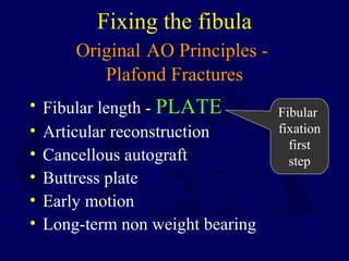 Fixing the fibula
Original AO Principles -
Plafond Fractures
• Fibular length - PLATE
• Articular reconstruction
• Cancellous autograft
• Buttress plate
• Early motion
• Long-term non weight bearing
Fibular
fixation
first
step
 
