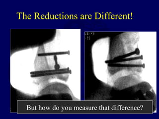 The Reductions are Different!
But how do you measure that difference?
 