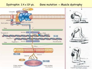 Dystrophin 2.4 x 106 pb.   Gene mutation → Muscle dystrophy
 