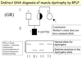 Indirect DNA diagnosis of muscle dystrophy by RFLP


   (GR)

                                       Conclusion:
                                       Mother´s sister does not
                          6 year boy
                                       have mutated allele


 DNA of family                          Normal allele for
 members + restriction                  dystrophin
 endonuclease,
 gel electrophoresis of                 Deletion mutation in the
 restriction fragments,                 dystrophin alelle
 Southern blotting
 