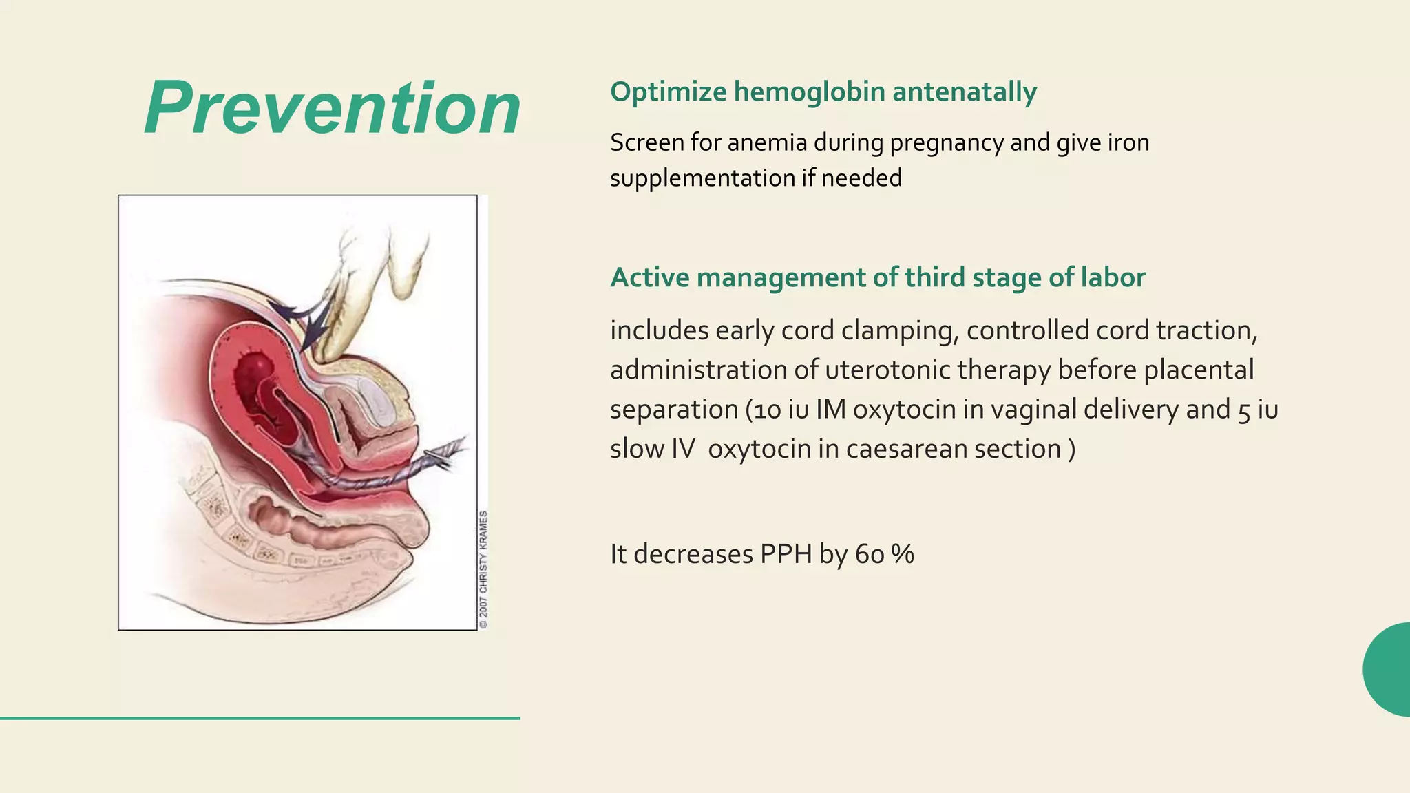 View of Lecture 21 Postpartum Hemorrhage .pptx