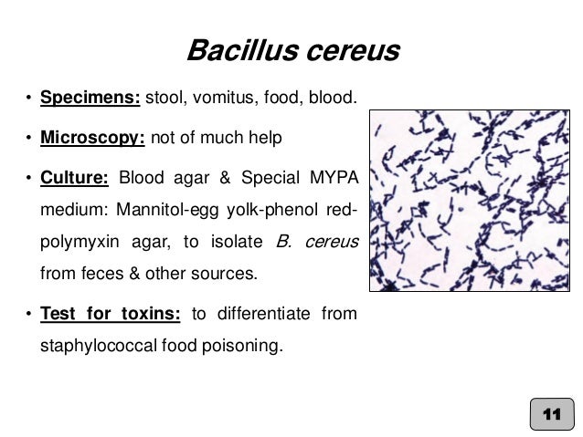 Bacilli In Stool - Stools Item