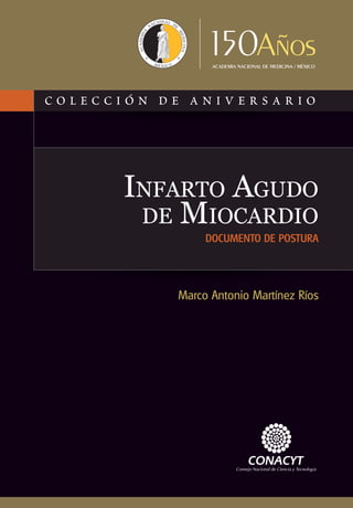 INFARTO AGUDO
DE MIOCARDIO
DOCUMENTO DE POSTURA
Marco Antonio Martínez Ríos
 