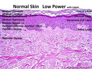 Normal Skin   Low Power with Labels