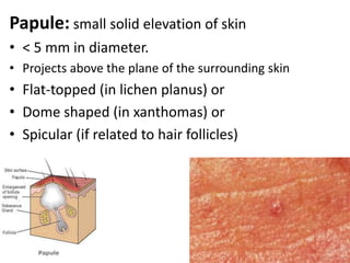 1- sebum expression   2- goose pimples from cold,    3- nipple erectionRaising of scrotum is by smooth dartos muscle