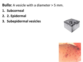 Skin appendages (Adnexa): SHANS:1. Sweat glands2. Hair3. Arrector pilli muscle4. Nails5. Sebaceous glands
