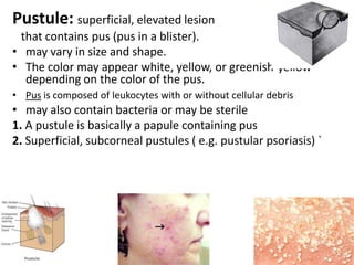 Skin appendages (Adnexa): SHANS:Hair: is human plumageHair follicle form before nine week of fetal life when hair germ grows obliquely down into dermis.It includes the following parts: Infandibulum: from surface to entrance of sebaceous g.