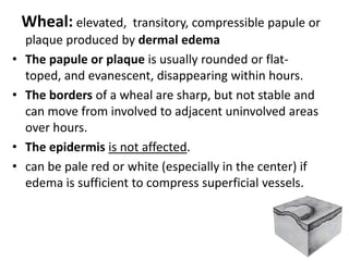 Free of hair areas: Lip, glans penis, labia minora, palms, soles 