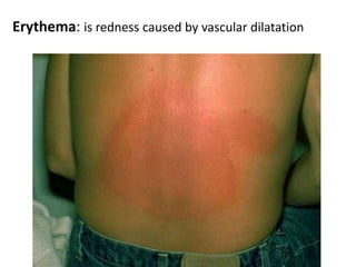 Hair cycle:anagen, catagen & telogen