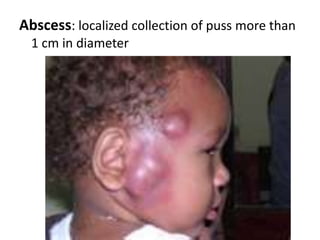 Typesof hair: 1- Lanugo hair   2- Vellus hair 3- Terminal hair