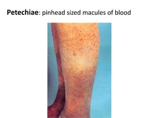 Hair: A hair follicle develops as a proliferation of the epidermal stratum germinativum and extends into the underlying mesenchyme.Nails:develop from thickened areas of epidermis at the tips of each digit called nail fields. Later these nail fields migrate onto the dorsal surface surrounded laterally and proximally by folds of epidermis called nail folds