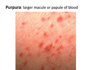 Both the sebaceous glands and sweat glands (+ mammary glands) are derived from the epidermis and grow downwards into the dermis.  The majority of sebaceous glands   originate as buds from developing    hair follicle root sheath.Sebaceous glands in the glans penis and labia minora (independent of hair follicles) develop similarly, but as buds from the epidermis.    