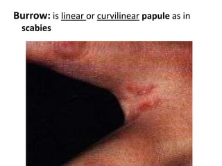 Keratinocyte Maturation: The aging of basal cells into the corneocytes (dead cells) is crucial.  The stratum corneum is important in preventing all manner of agents from entering the skin, including micro-organisms, water and particulate matter.  It's the epidermis that also prevents loss of vital body fluids. The dividing basal cell on average replicates every 200 to 400 hours, and the resulting cell takes 14 days to differentiate and 14 days to be shed.