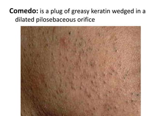 Hair Growth Unlike most mammals, humans are considered "nude“ رووت ; thus, hair does not play the same vital role of heat conservation.  However, the hair on the scalp does protect us from UV radiation and minor injury.  Today, hair is of cosmetic value.Hair growth is cyclical and has three phases.  The 3 phases are: 
