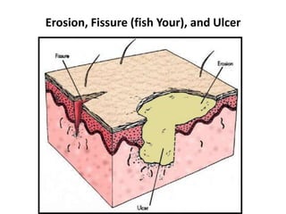 Dermatological General & Specific Terms:Dermatologists have some universal terms that are used when describing skin conditions:Lesion:Eruption (or rash):2 Types of Skin Lesions:    1- Primary Skin Lesions   2- Secondary Skin Lesions