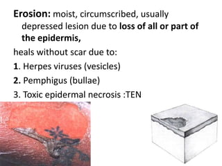 1- Primary Lesions: are the first to appear and are due to the disease or abnormal state.  Must be distinguished from secondary or induced lesionsMaculePapuleNoduleVesicleBullaPustuleCystPlaqueWheal, Erythema, abscess, Angiodema, Tumor, Petechiae, Purpura, Ecchymosis, Haematoma, Burrow, Comedo, Telangiectasia & Poikiloderma