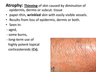 Bulla: A vesicle with a diameter > 5 mm. Subcorneal2. EpidermalSubepidermal vesicles 