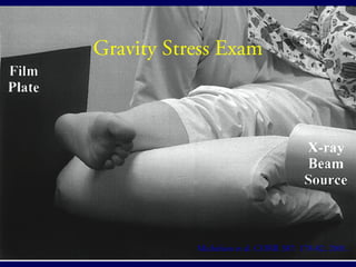 Gravity Stress Exam 
Michelson et al. CORR 387: 178-82, 2001. 
 