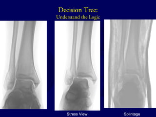 Decision Tree: 
Understand the Logic 
Stress View Splintage 
 