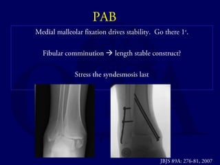 PAB 
Medial malleolar fixation drives stability. Go there 1st. 
Fibular comminution  length stable construct? 
Stress the syndesmosis last 
JBJS 89A: 276-81, 2007 
 