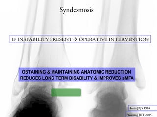 Syndesmosis 
IF INSTABILITY PRESENT OPERATIVE INTERVENTION 
OBTAINING & MAINTAINING ANATOMIC REDUCTION 
REDUCES LONG TERM DISABILITY & IMPROVES sMFA 
Leeds JBJS 1984 
Weening JOT 2005 
 