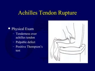 L13 ankle ligament injuries | PPT