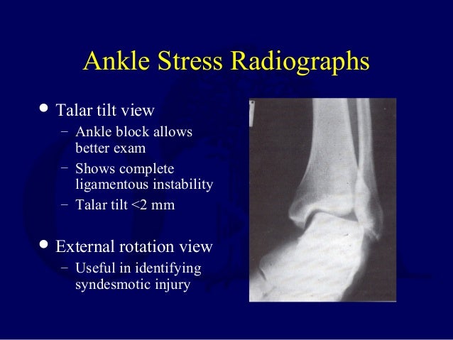 L13 Ankle Ligament Injuries