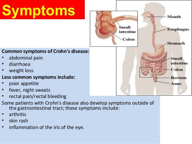 What are some common symptoms of colon inflammation?